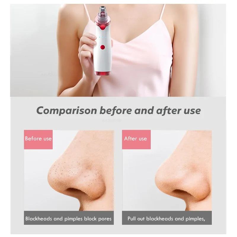 Pore Device