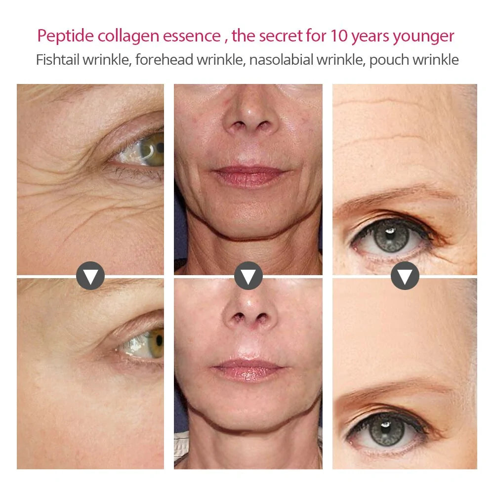 Collagen Peptides