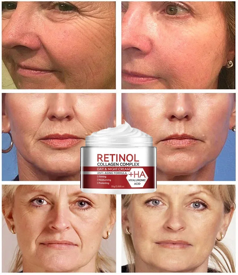 Retinol Remove Wrinkles Face Cream Lifting Firming Anti-Aging Fades Fine Lines Moisturizing Brighten Skin Care Korean Cosmetics