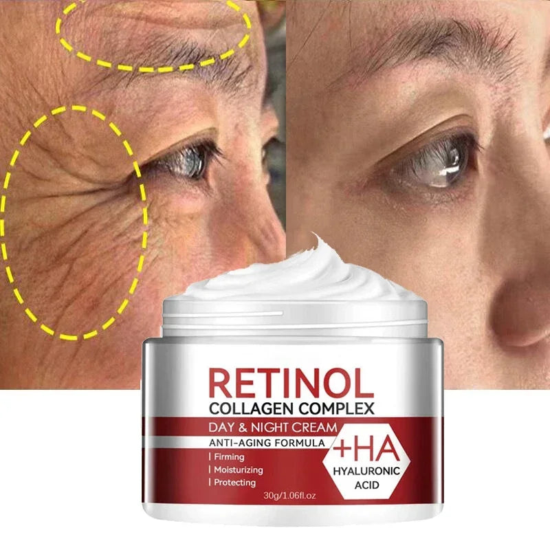 Retinol Remove Wrinkles Face Cream Lifting Firming Anti-Aging Fades Fine Lines Moisturizing Brighten Skin Care Korean Cosmetics