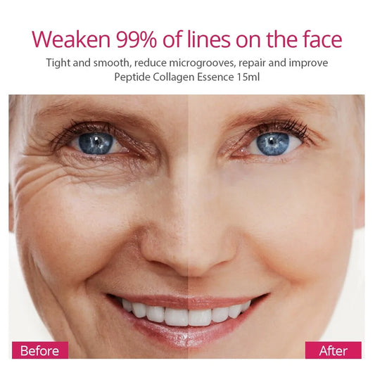 Collagen Peptides